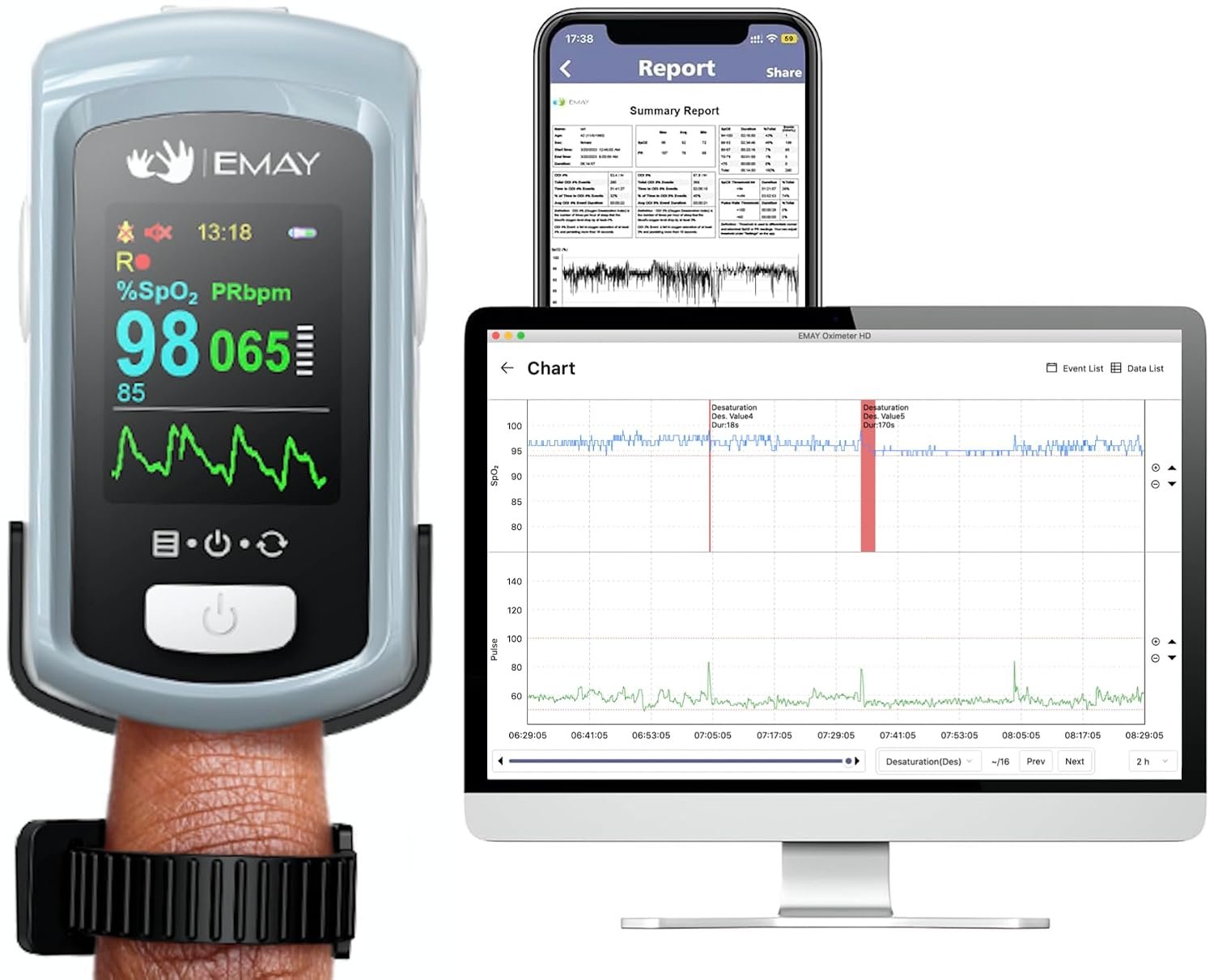EMAY Sleep Oxygen Monitor with PC Software & App | Bluetooth Pulse Oximeter Rechargeable for Overnight & Continuous SpO2 Tracking with 72 Hours Built-in Memory | Gives Informative Report & Analysis